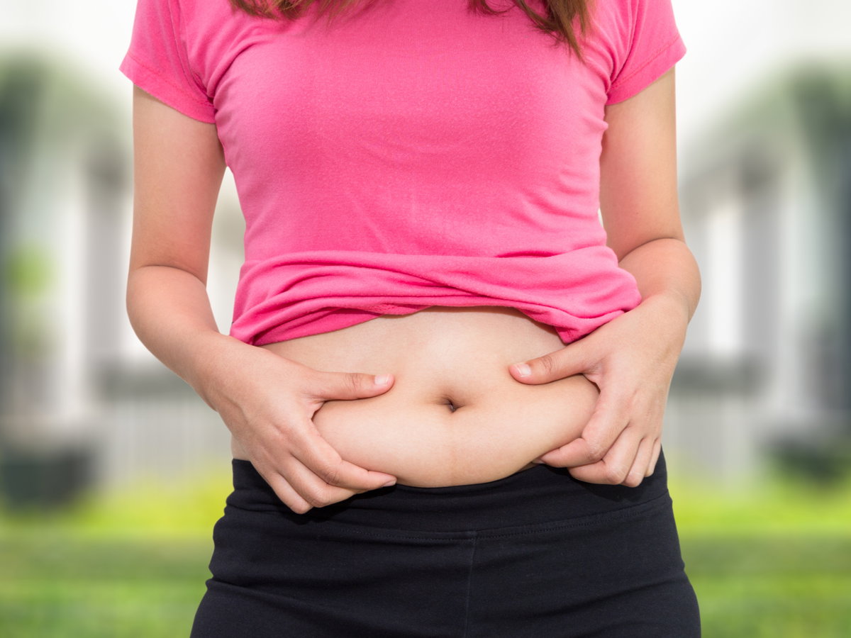 Speckfalte am Bauch einer Frau