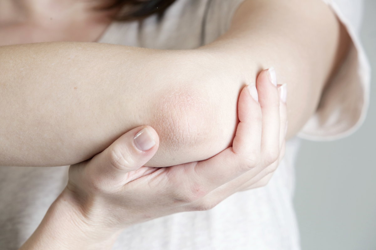 Arm einer Frau