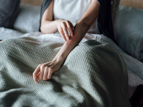 Nesselsucht: Die besten Hausmittel gegen Quaddeln