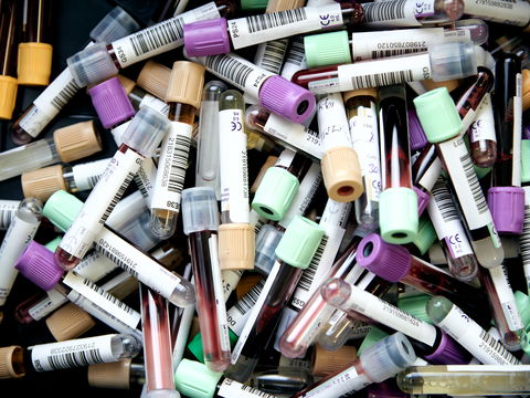 Entzündungswerte im Blut: Was diese 4 Parameter bedeuten