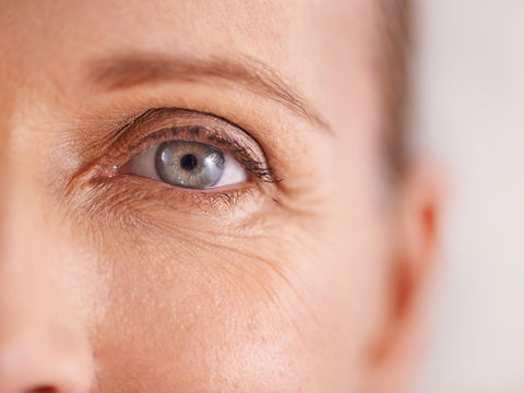 Krähenfüße: Wie die Augenfalten entstehen und was dagegen hilft