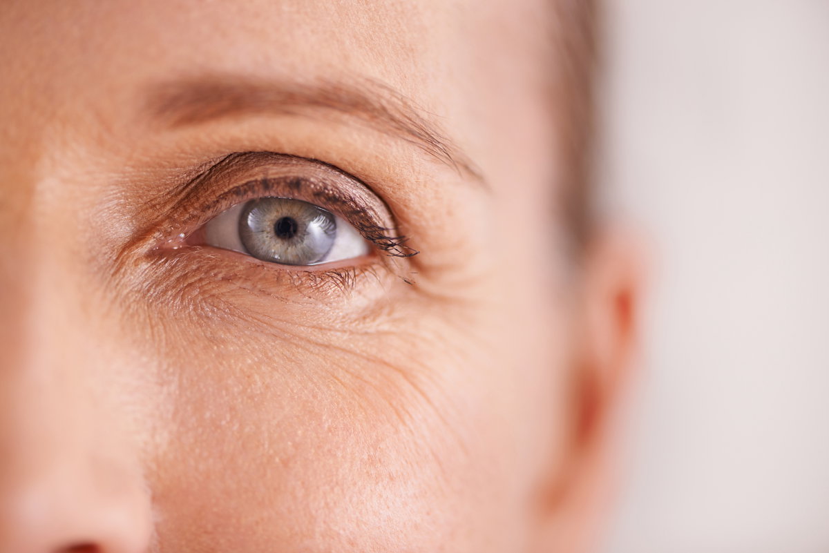 Falten am Augen