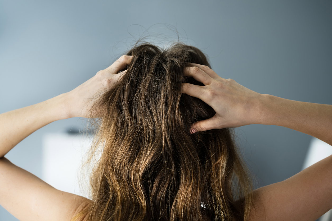 Schuppenshampoo: Das sind die Testsieger laut Öko-Test