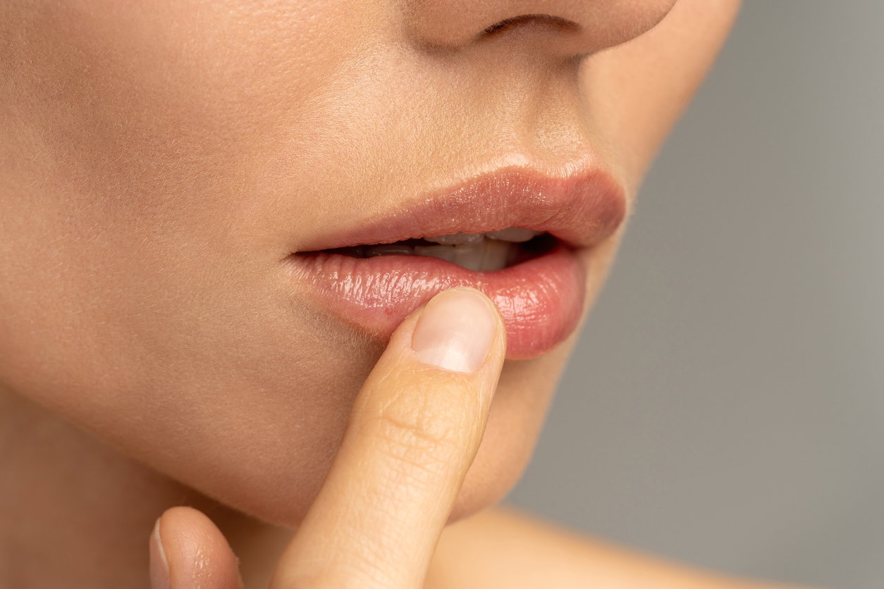 Pickel an der Lippe oder Herpes: Unterschied & 5 Hausmittel, die jetzt helfen
