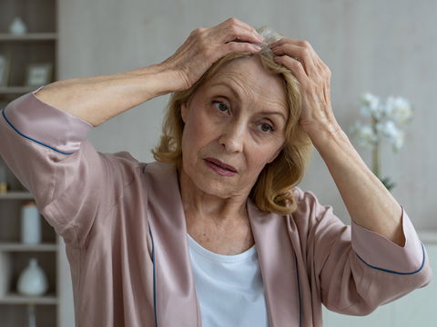 Schuppenflechte am Kopf: Ursachen und Hilfe bei Psoriasis