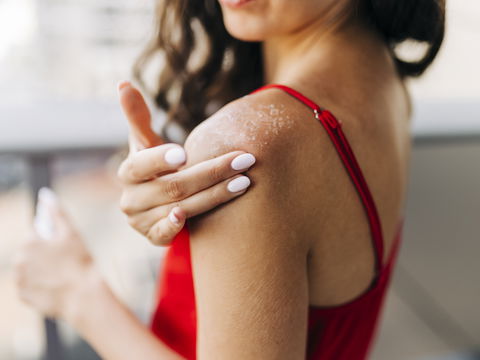 Haut pellt sich nach Sonnenbrand: 3 Tipps, die helfen