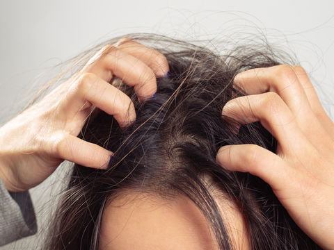 Gesunde Haut: 4 Tipps gegen eine juckende Kopfhaut
