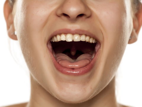 Leukoplakie: Alles, was zu tun ist