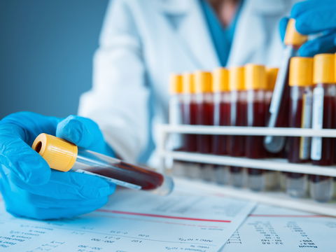 Studie zeigt: Hepatitis-E-Mutation macht Therapie so gut wie unwirksam
