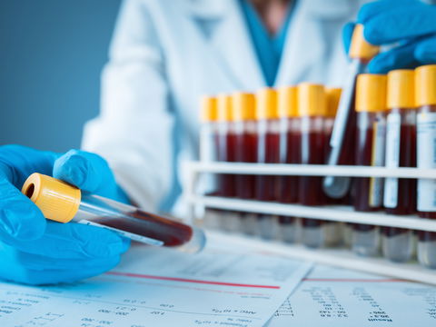 Studie zeigt: Hepatitis-E-Mutation macht Therapie so gut wie unwirksam