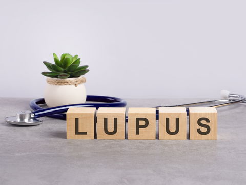 Lebenserwartung mit Lupus: Das ist die Prognose der Autoimmunerkrankung