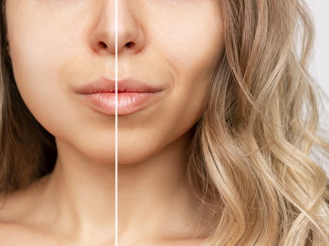Buccal Fat Removal: Kann man Hamsterbacken einfach wegschneiden?