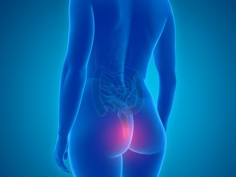 Hämorrhoiden vorbeugen: Mit diesen 6 Tipps