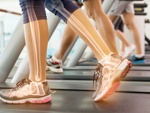 Osteoporose vorbeugen: Die besten Tipps für starke Knochen