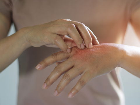Hände schälen sich: Ursachen und was Sie tun können