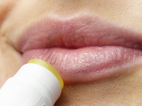 Lippenherpes: Tipps zur Vorbeugung und effektiven Bekämpfung