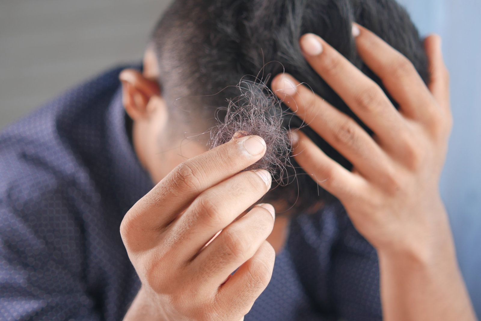 Regenerative Ansätze gegen Haarausfall