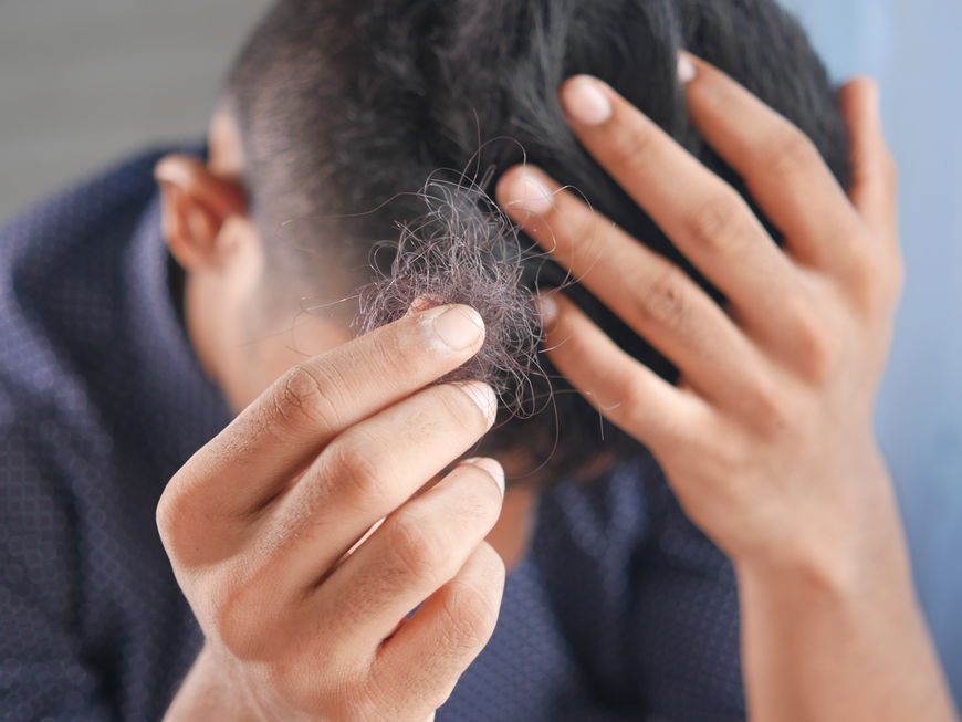 Mann hält Haarbüschel in der Hand
