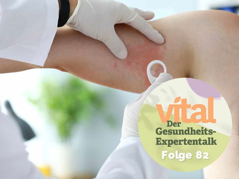 Arzt macht deutlich: „Gürtelrose ist eine ernstzunehmende Erkrankung“ – Dr. Georg Friese im Gespräch