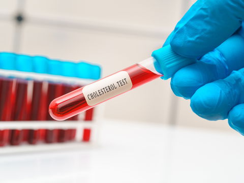HDL-Cholesterin: Alles, was Sie über das "gute" Lipoprotein wissen sollten