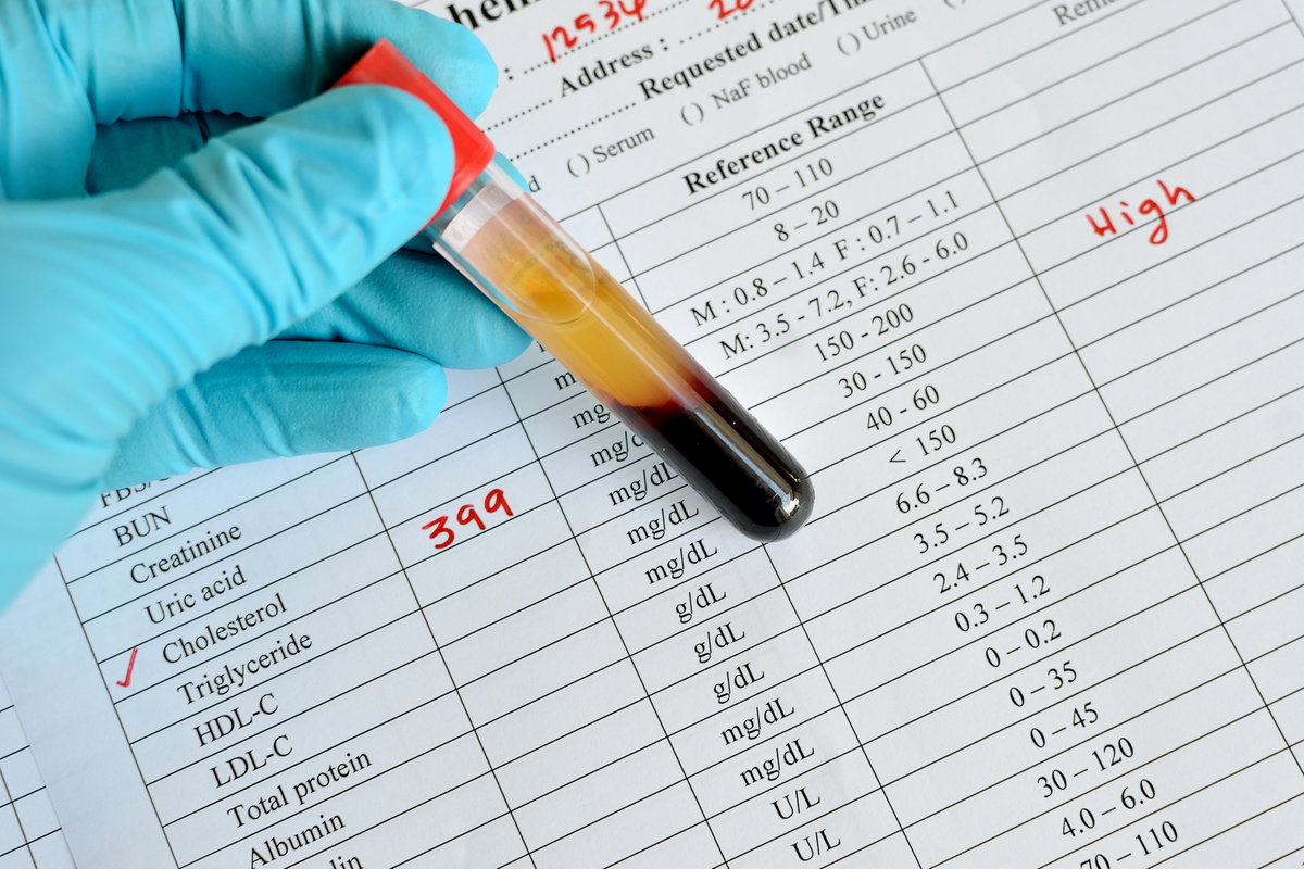 Neue Studien zeigen jedoch, dass zu viel HDL-Cholesterin auch schädlich sein kann.