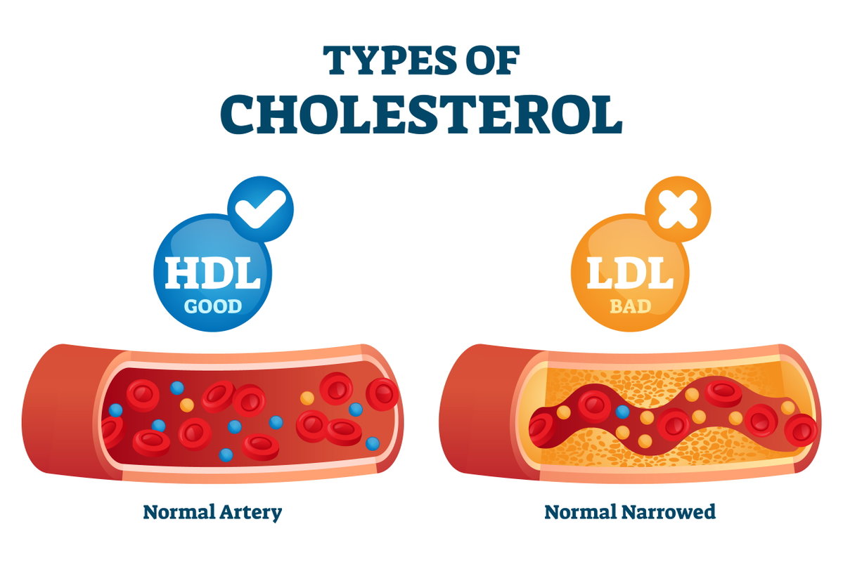 HDL Cholesterin und LDL Cholesterin im Vergleich