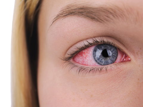 Thrombose im Auge: Ursachen, Symptome und Behandlung