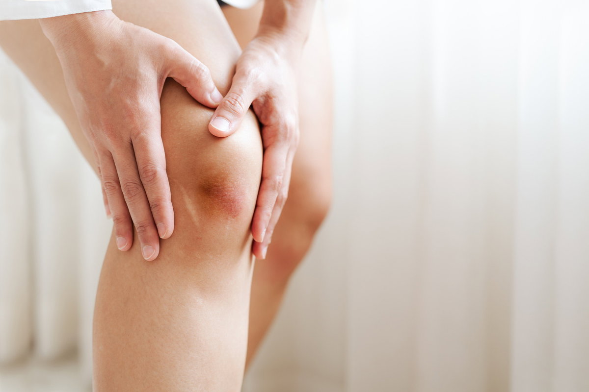 Blauer Fleck am Knie