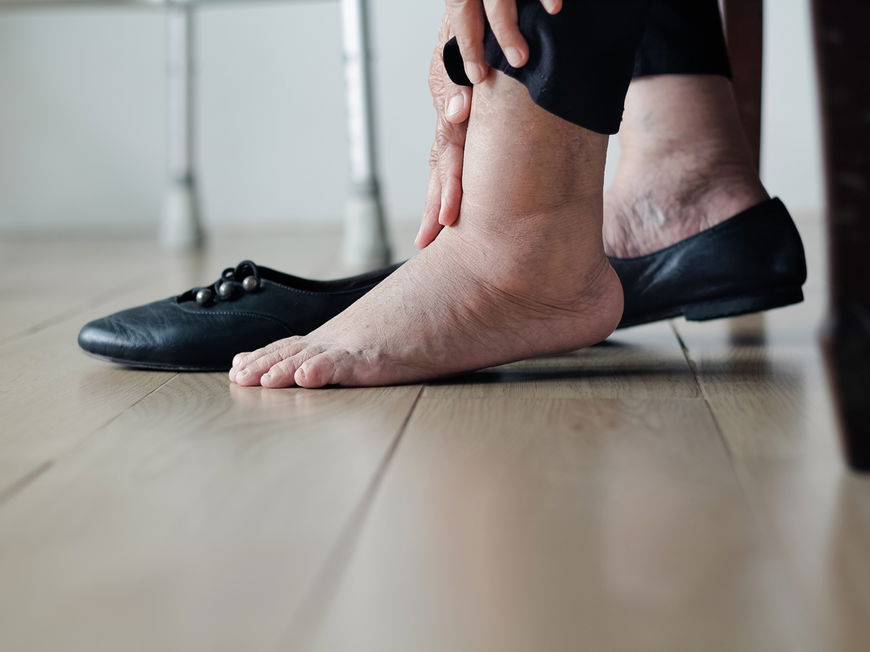 Charcot Fuß