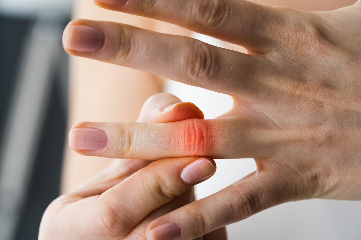 Gicht im Finger