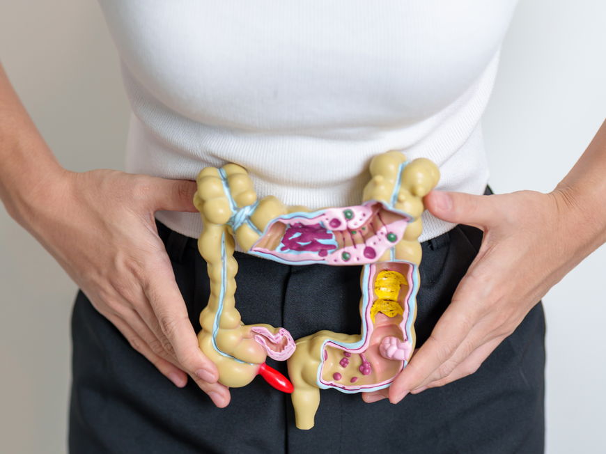 Frau hält ein Modell vom Dickdarm vor ihren Bauch
