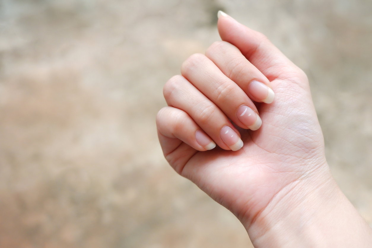 Weiße Punkte auf Fingernägeln: Welche Ursachen stecken dahinter?
