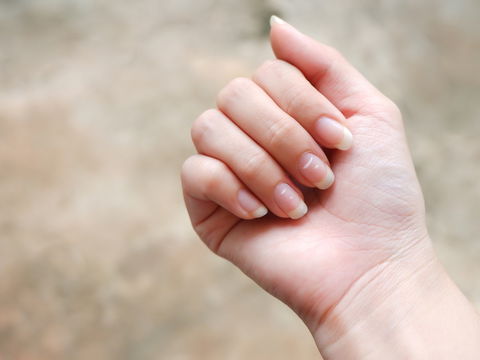 Weiße Punkte auf Fingernägeln: Welche Ursachen stecken dahinter?