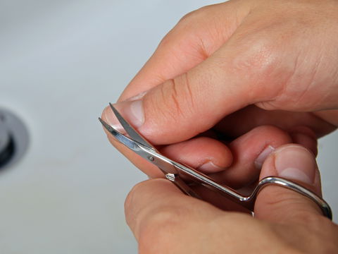 Fingernägel zu kurz geschnitten? Tipps zur schnellen Genesung und Vorbeugung