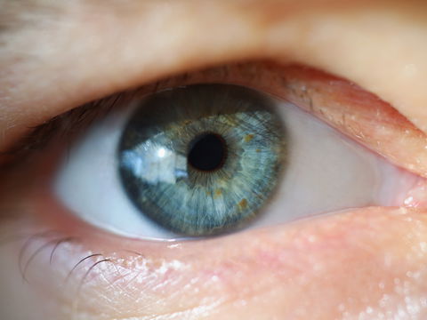 Hängendes Augenlid: Woran es liegt und was dagegen hilft