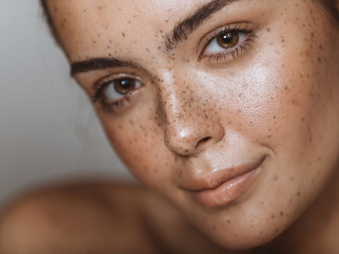 Sommersprossen mit Henna: So gelingt ein natürliches Ergebnis 