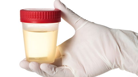 Urin durchsichtig wie Wasser: Ist das schlimm?