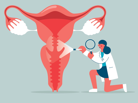 Endometriose: Die unterschätzte Frauenkrankheit