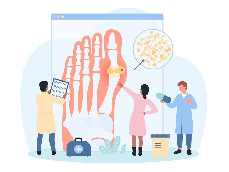 Mediziner studieren medizinisches Fußdiagramm zur Diagnose