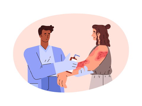 Gürtelrose: Was Sie über das schmerzhafte Herpes zoster wissen sollten