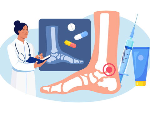 Rheuma: Symptome und Behandlung bei rheumatoider Arthritis
