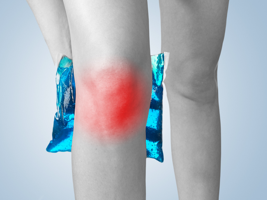 Eine frühzeitige Diagnose bei einer Bakerzyste am Knie ist wichtig, um Komplikationen zu vermeiden.