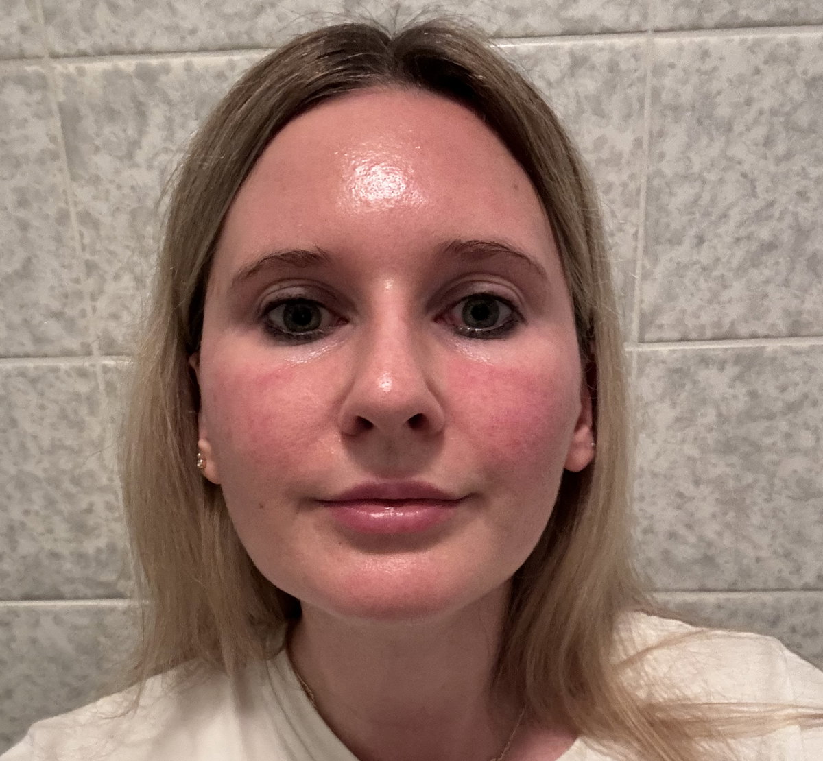 Nach der Gua Sha Massage