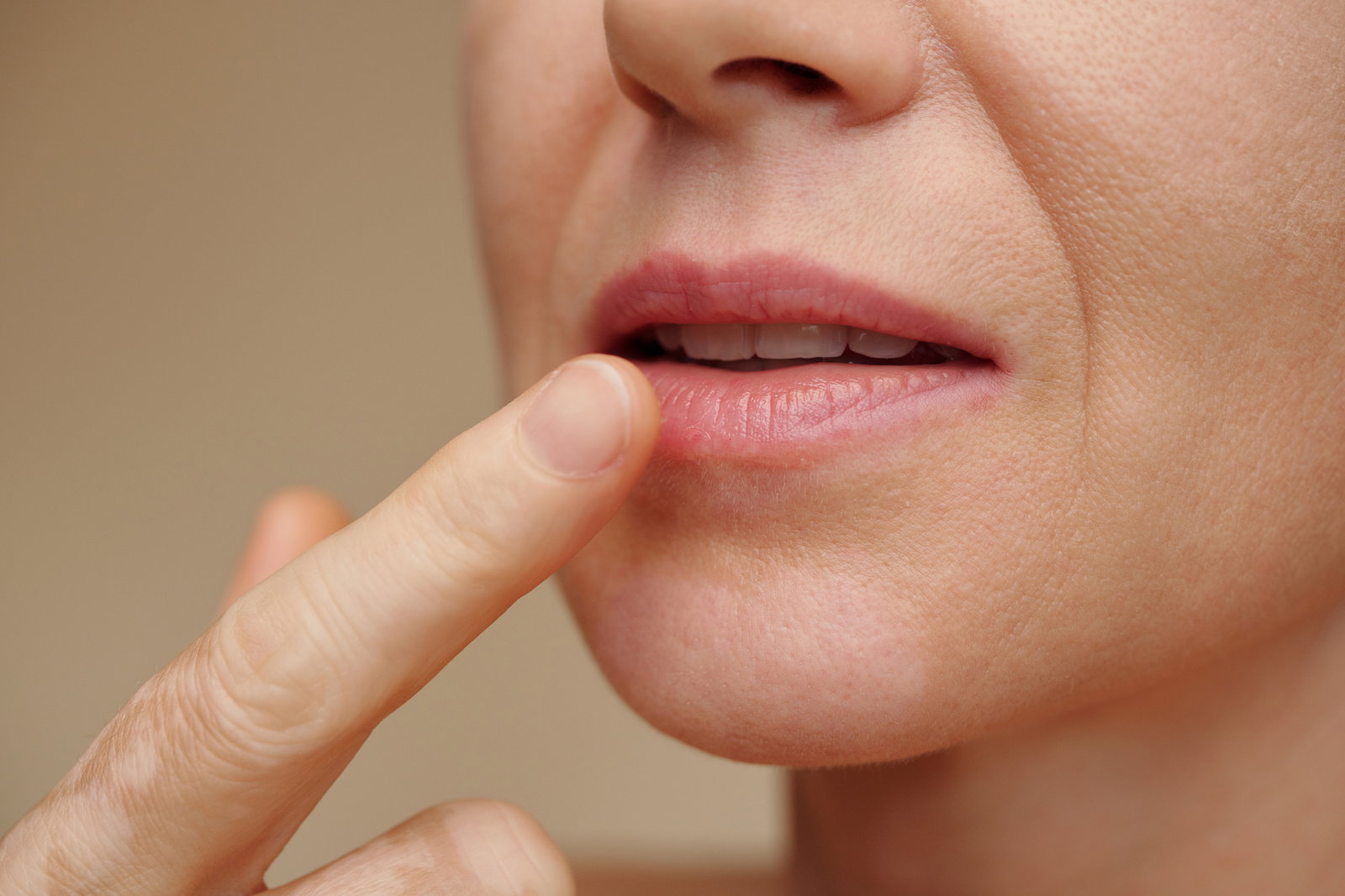 Blauer Fleck auf der Lippe: Welche Ursachen gibt es? 