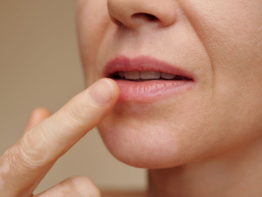 Frau fasst mit dem Finger an ihre Lippe