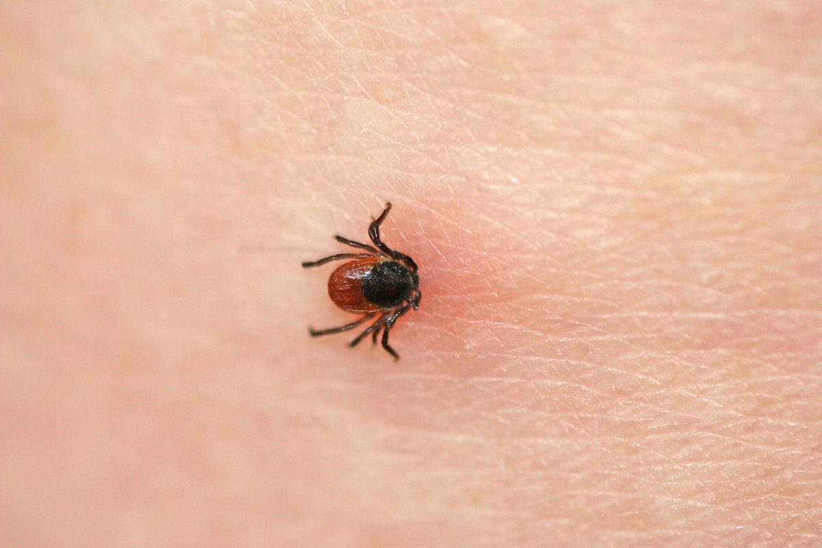 Zeckenbiss juckt und ist rot? Das müssen Sie wissen