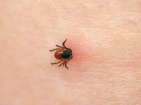 Zeckenbiss juckt und ist rot? Das müssen Sie wissen