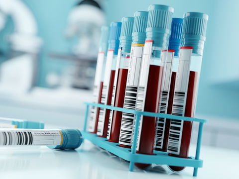 Studie: Neuer Bluttest kann 67 Krankheiten voraussagen