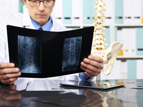 Künstliche Bandscheibe: Was Sie zur Prothese wissen müssen
