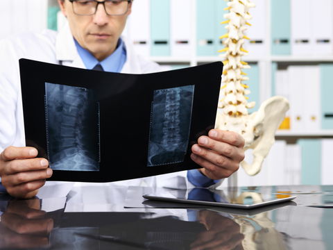 Künstliche Bandscheibe: Was Sie zur Prothese wissen müssen